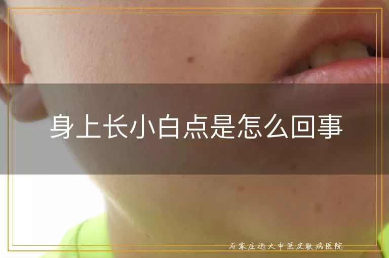 身上长小白点是怎么回事