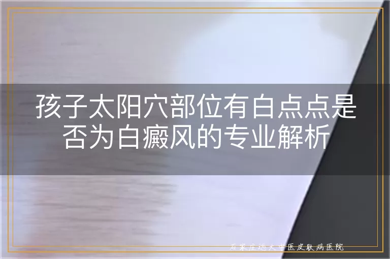 孩子太阳穴部位有白点点是否为白癜风的专业解析