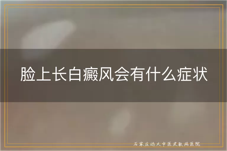 脸上长白癜风会有什么症状