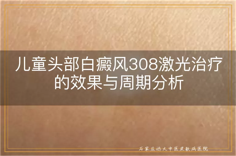 儿童头部白癜风308激光治疗的效果与周期分析