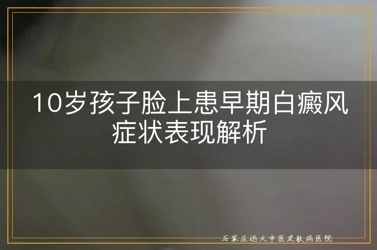 10岁孩子脸上患早期白癜风症状表现解析