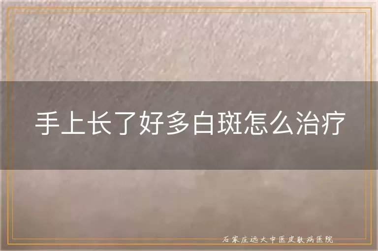 手上长了好多白斑怎么治疗