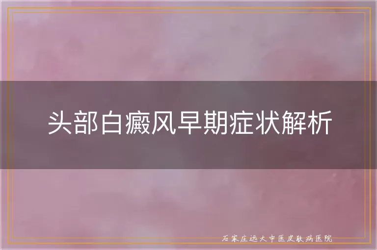 头部白癜风早期症状解析
