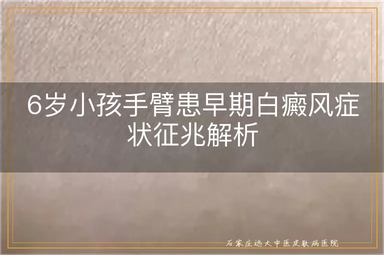 6岁小孩手臂患早期白癜风症状征兆解析