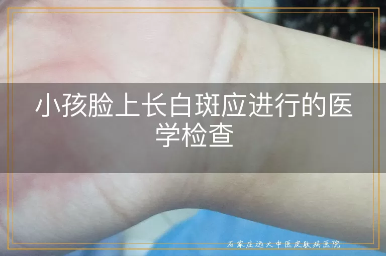 小孩脸上长白斑应进行的医学检查