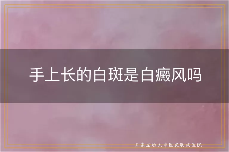手上长的白斑是白癜风吗