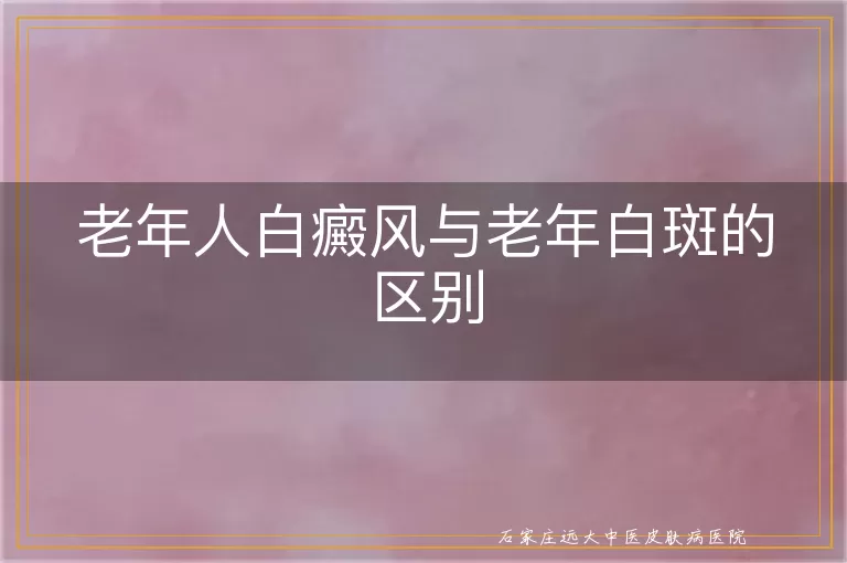老年人白癜风与老年白斑的区别