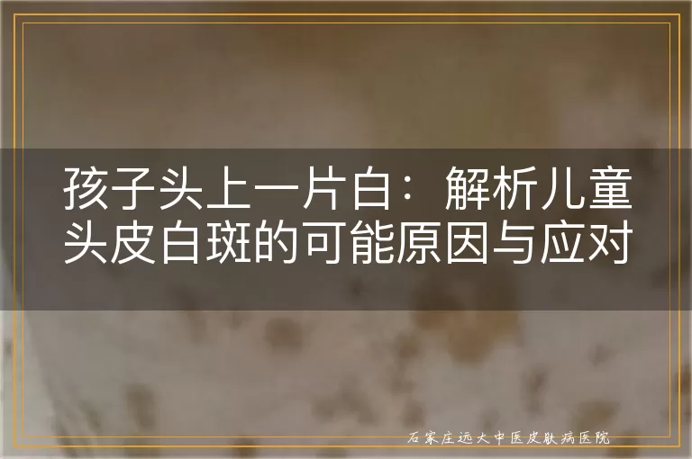 孩子头上一片白：解析儿童头皮白斑的可能原因与应对措施