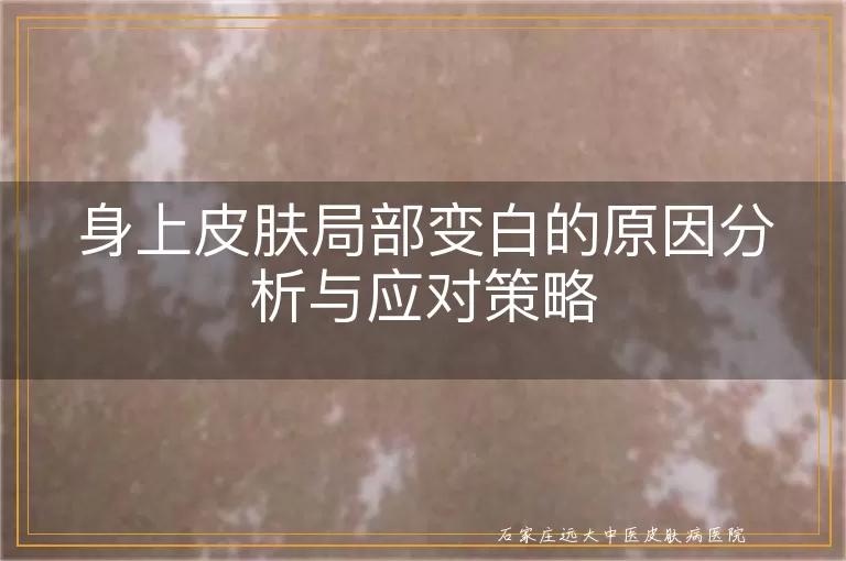 身上皮肤局部变白的原因分析与应对策略