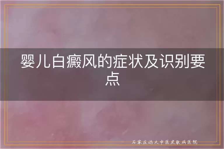 婴儿白癜风的症状及识别要点