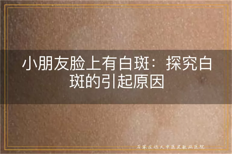 小朋友脸上有白斑：探究白斑的引起原因