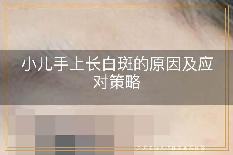 小儿手上长白斑的原因及应对策略