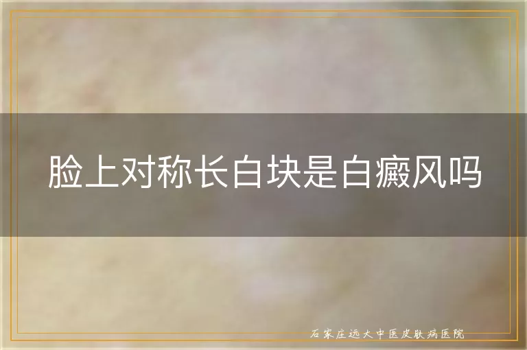 脸上对称长白块是白癜风吗