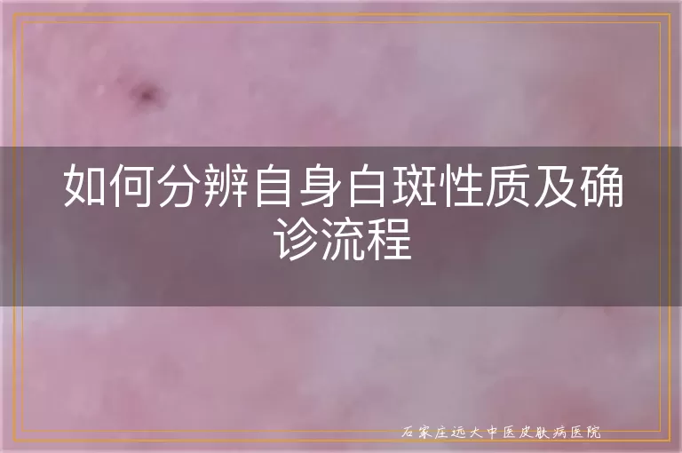 如何分辨自身白斑性质及确诊流程