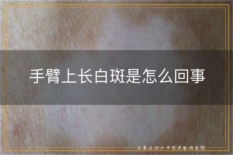 手臂上长白斑是怎么回事