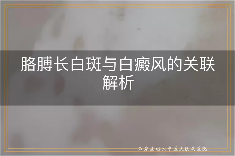 胳膊长白斑与白癜风的关联解析