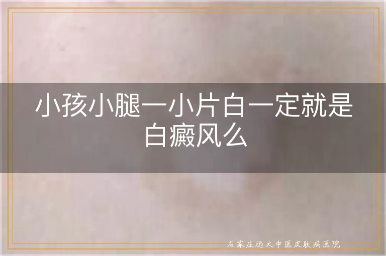 小孩小腿一小片白一定就是白癜风么
