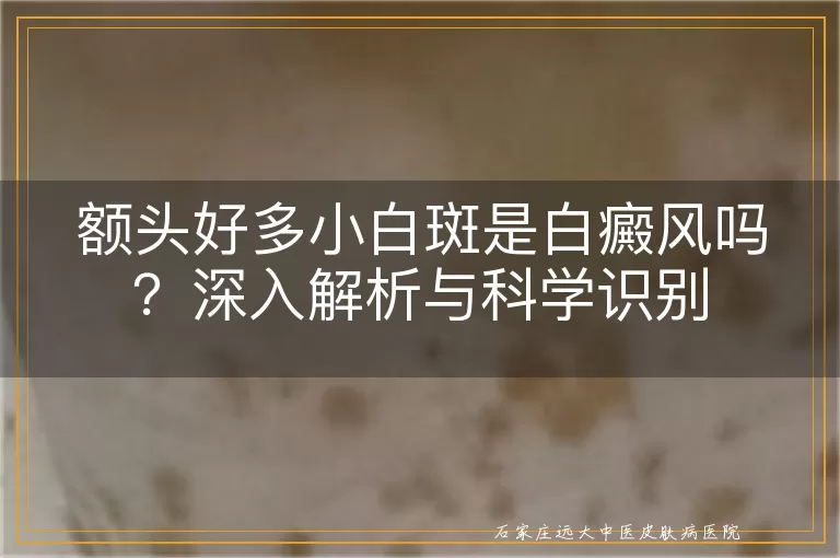 额头好多小白斑是白癜风吗？深入解析与科学识别