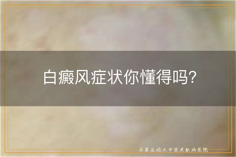 白癜风症状你懂得吗？