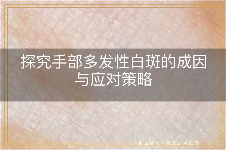 探究手部多发性白斑的成因与应对策略