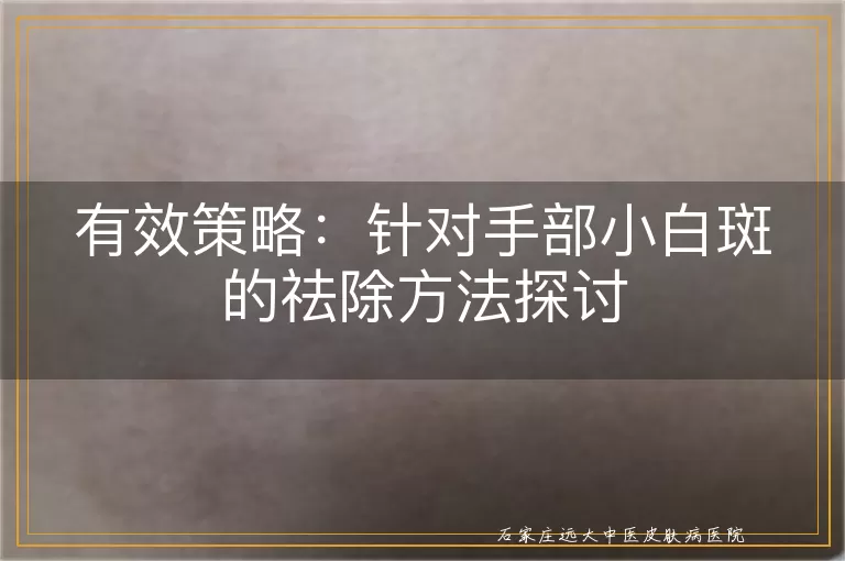 有效策略：针对手部小白斑的祛除方法探讨