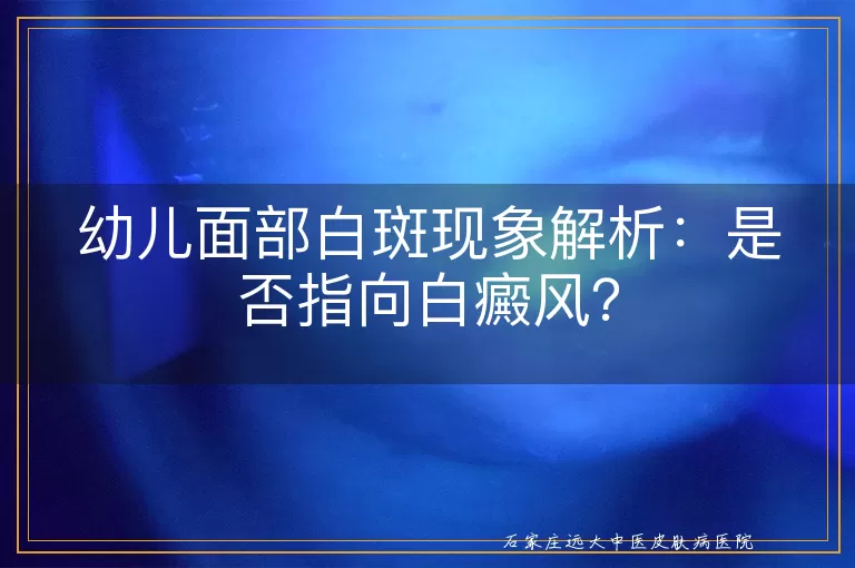 幼儿面部白斑现象解析：是否指向白癜风？