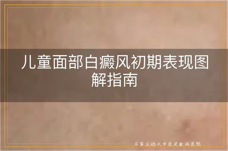儿童面部白癜风初期表现图解指南