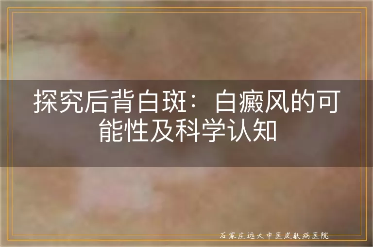 探究后背白斑：白癜风的可能性及科学认知