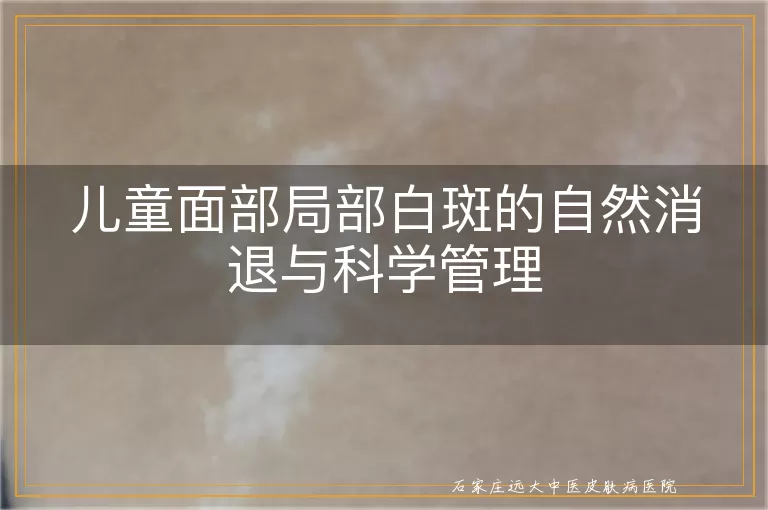 儿童面部局部白斑的自然消退与科学管理