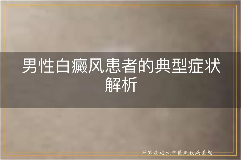 男性白癜风患者的典型症状解析