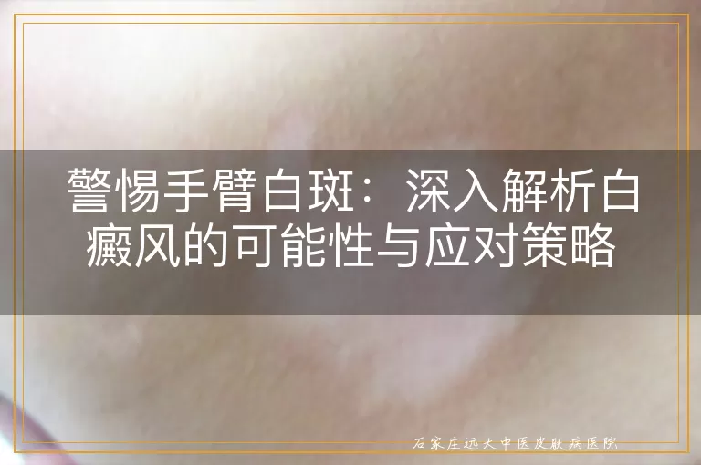 警惕手臂白斑：深入解析白癜风的可能性与应对策略