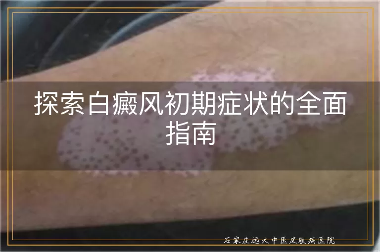 探索白癜风初期症状的全面指南
