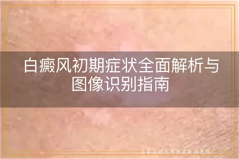 白癜风初期症状全面解析与图像识别指南