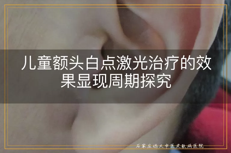 儿童额头白点激光治疗的效果显现周期探究