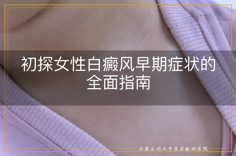 初探女性白癜风早期症状的全面指南