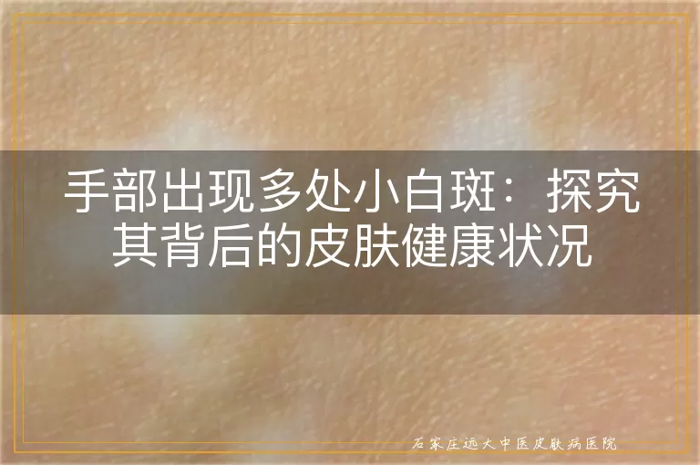 手部出现多处小白斑：探究其背后的皮肤健康状况