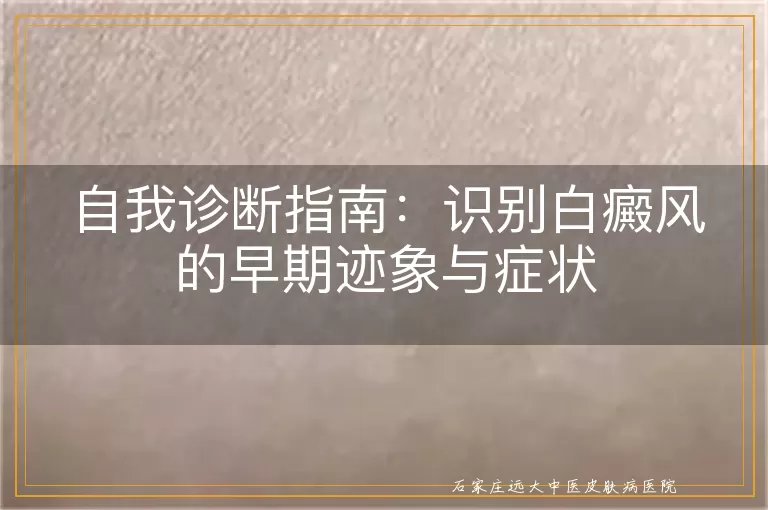 自我诊断指南：识别白癜风的早期迹象与症状