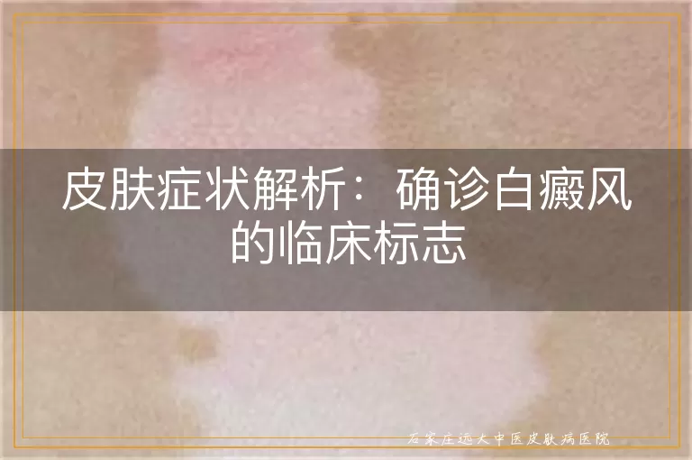 皮肤症状解析：确诊白癜风的临床标志