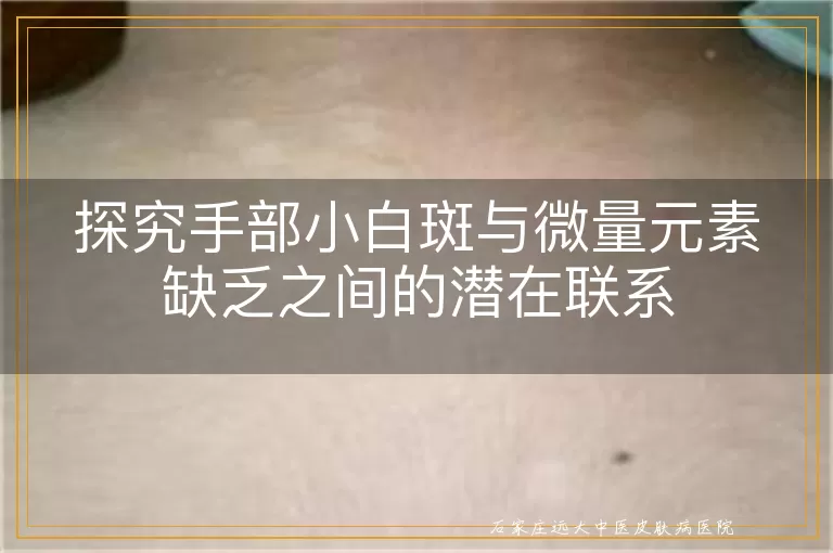 探究手部小白斑与微量元素缺乏之间的潜在联系