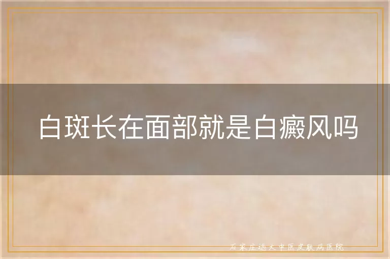 白斑长在面部就是白癜风吗