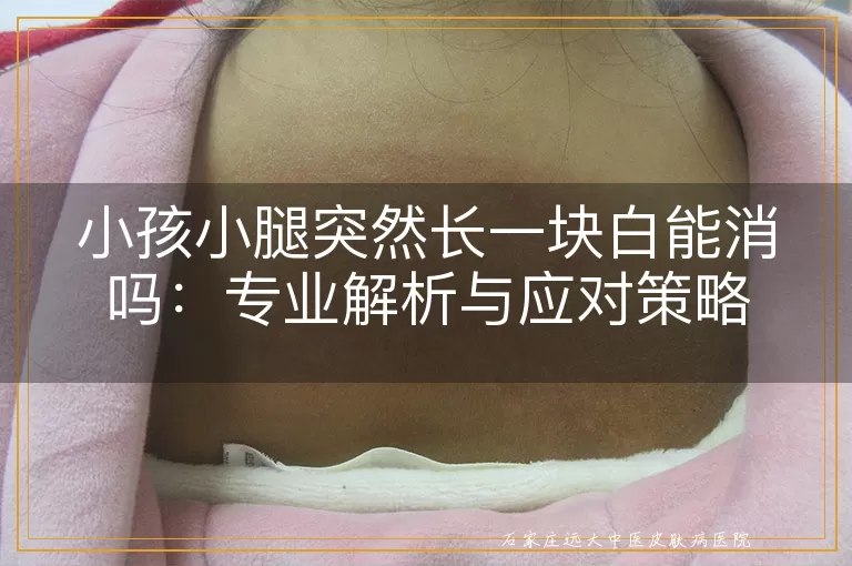小孩小腿突然长一块白能消吗：专业解析与应对策略