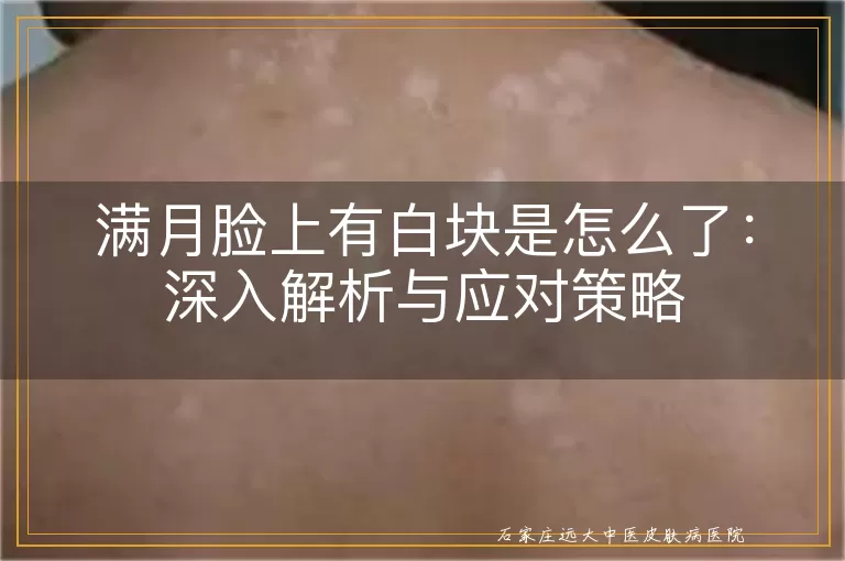 满月脸上有白块是怎么了：深入解析与应对策略