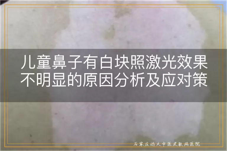 儿童鼻子有白块照激光效果不明显的原因分析及应对策略
