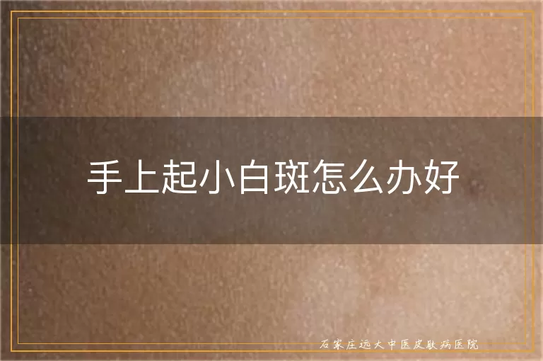 手上起小白斑怎么办好