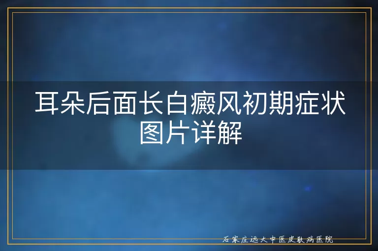 耳朵后面长白癜风初期症状图片详解