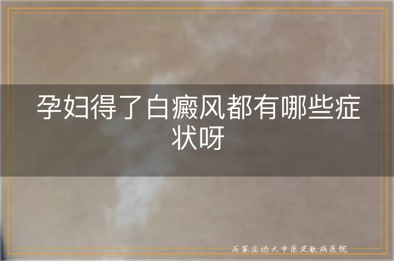 孕妇得了白癜风都有哪些症状呀