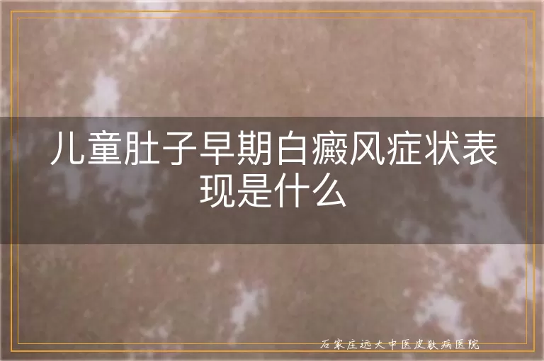 儿童肚子早期白癜风症状表现是什么