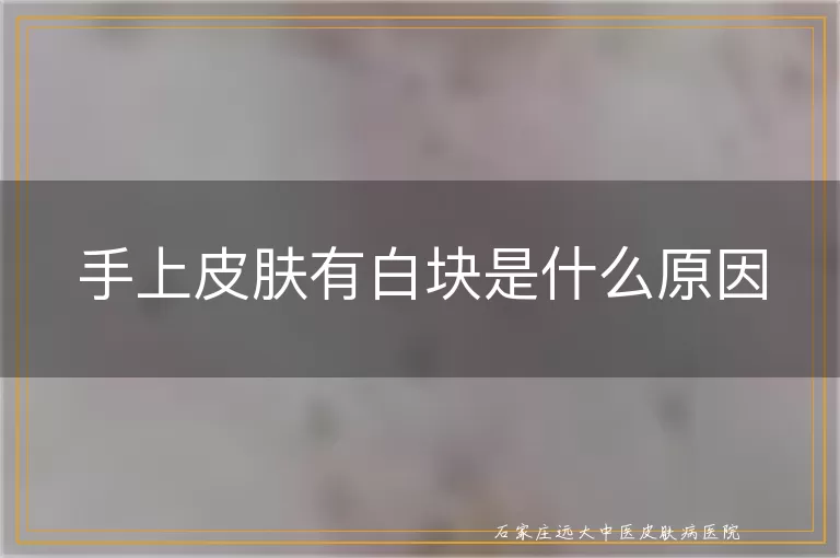 手上皮肤有白块是什么原因