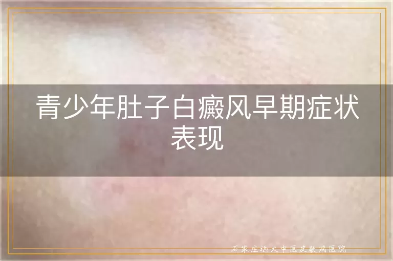 青少年肚子白癜风早期症状表现