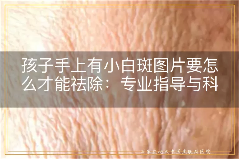 孩子手上有小白斑图片要怎么才能祛除：专业指导与科学方法